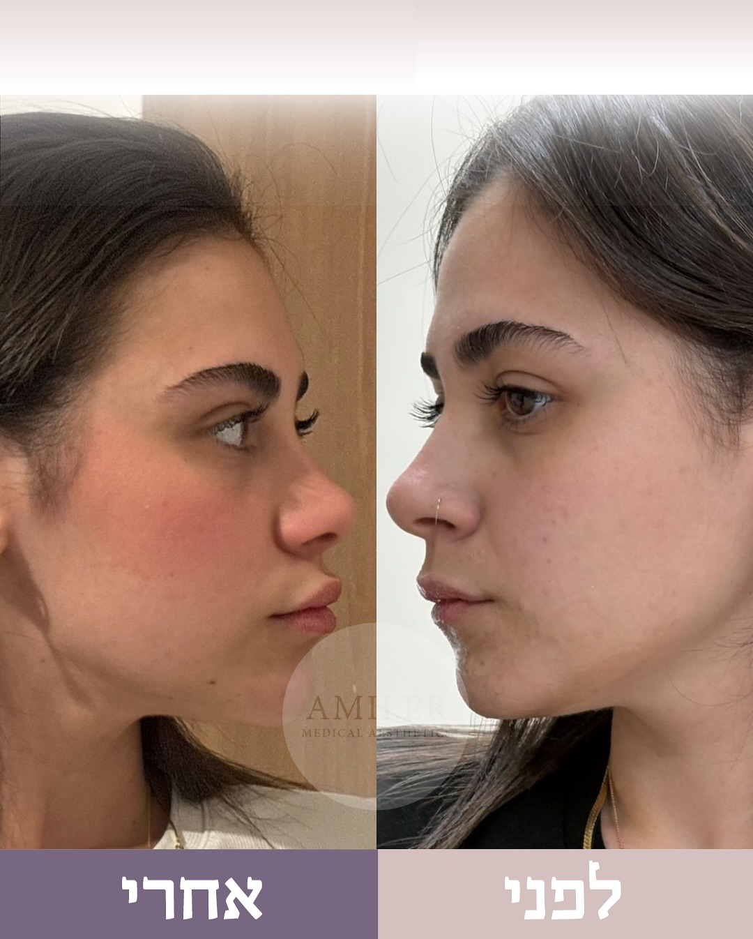 תוצאות טיפול 1