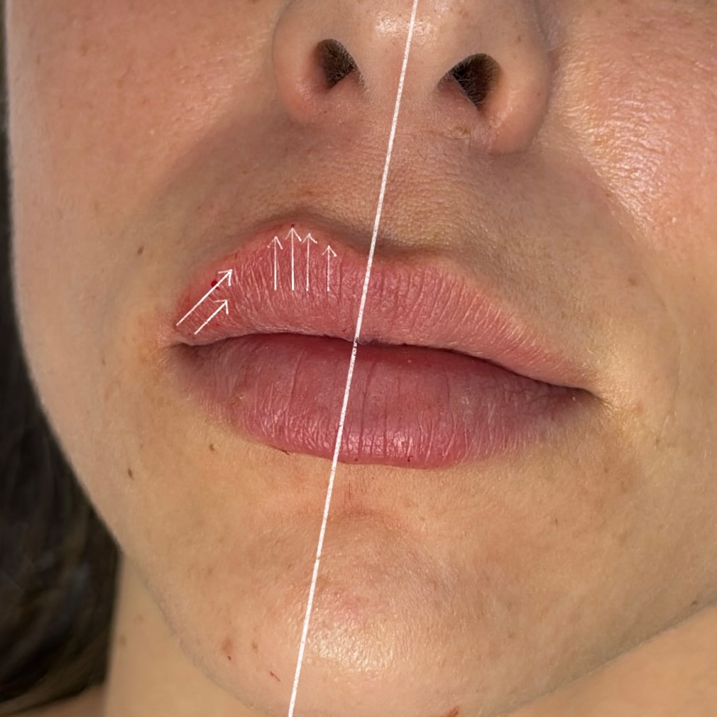 תוצאות טיפול 2