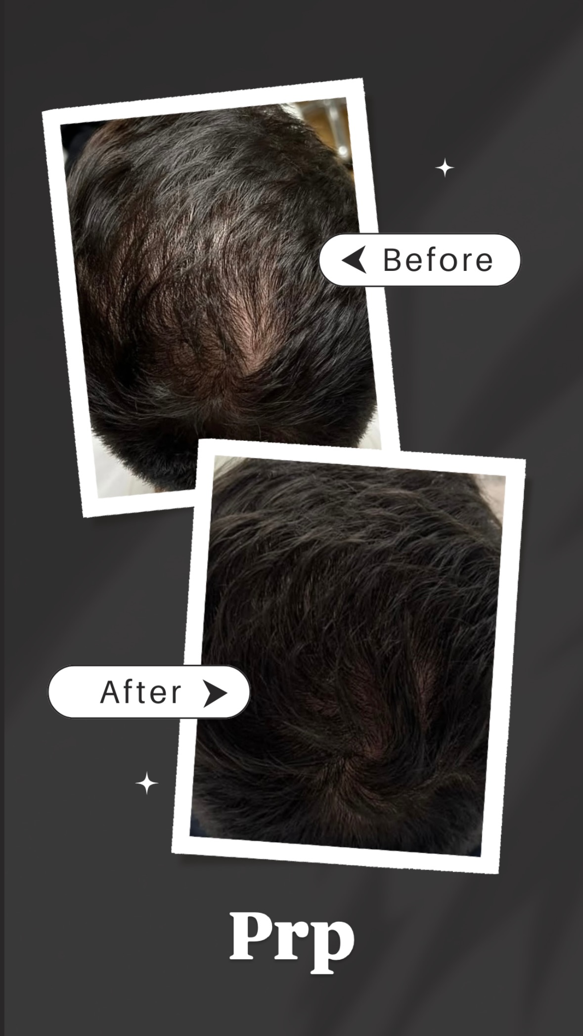 תוצאות טיפול 3