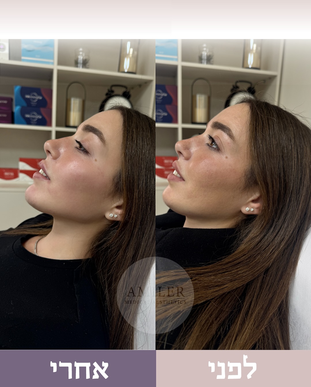 תוצאות טיפול 4